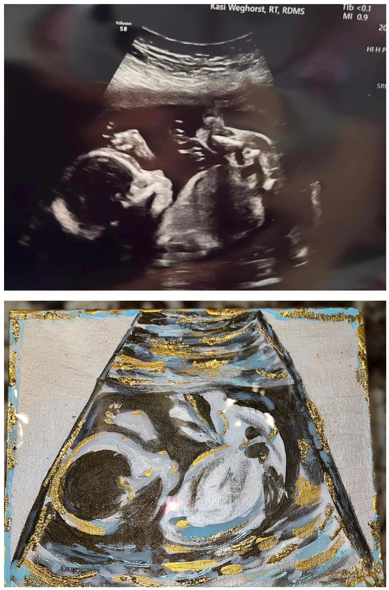 Sonogram Painting